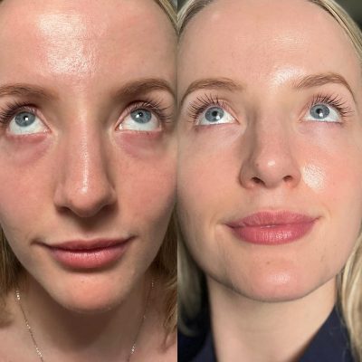 550807336_18408667033117997_2324326087174427423_n